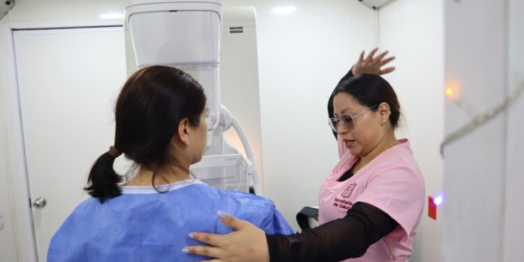 Más de 50 mil mujeres beneficiadas en 2025 con mastografías gratuitas: SSM